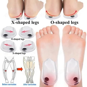 Ортопедические Стельки из Силиконового Геля для Ног С Магнитным Массажем, Стелька O/X Для Коррекции Вальгусно-Варусной Деформации Ног, Подошвенный Фасциит, Уход За Ногами